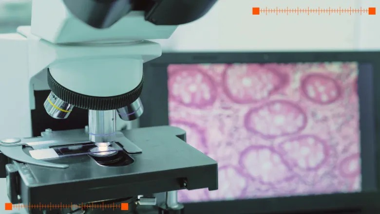 ai for breast cancer treatment