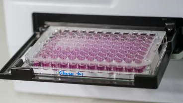 Immunogenetics led by Professor Tim Vyse